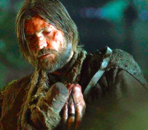(2e partie) Jaime Lannister après avoir perdu sa main